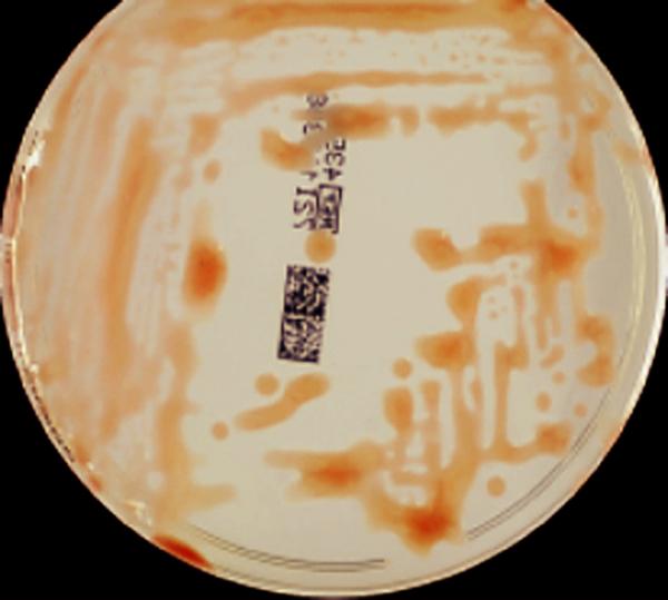 Figura 1. Colonias de Roseomonas en agar Sabouraud. Qué microorganismo fue el agente el agente causal de esta bacteriemia?