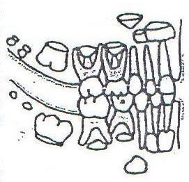 3.-Identificación en dibujos de denticiones, la edad aproximada a la que