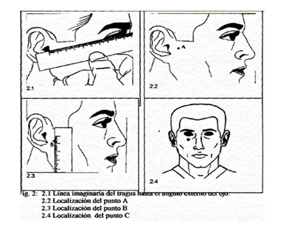 Seguido a esto indique al paciente repetir el movimiento de apertura y cierre varias veces, mientras se mantiene el pulpejo de los dedos índice sobre los puntos B, marcados a ambos lados de la cara,