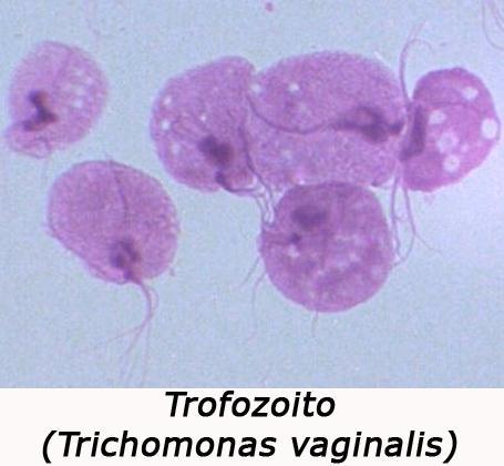Trichomonas vaginalis Parásito protozoario móvil flagelado Coloniza el epitelio humano del tracto urogenital.