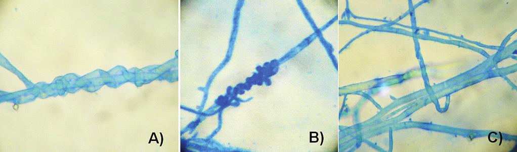 A) Capacidad antagónica de Trichoderma harzianum sobre Fusarium semitectum. B) Capacidad antagónica de T. theobromicola sobre F. semitectum. Fig. 3.
