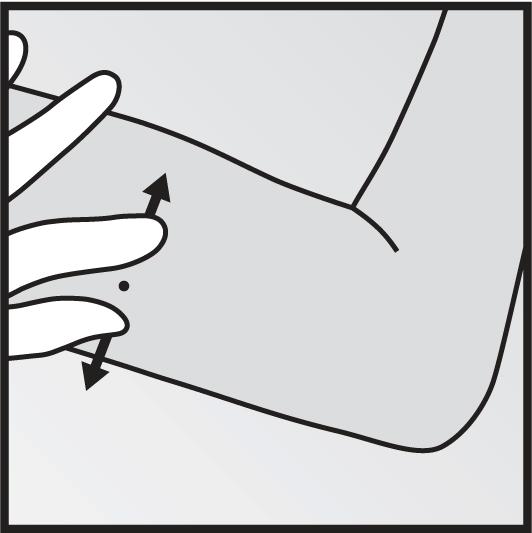 Si el tapón no sale con facilidad el aplicador no debe ser utilizado. Puede ver el color blanco del implante examinando la punta de la aguja.