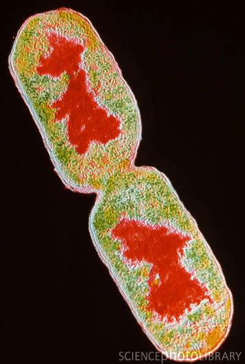 Plasmidios Definición son pedazos de DNA circular que se encuentran libres en el citoplasma o adheridos al cromosoma bacteriano.