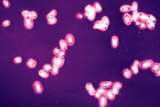 (b) Bacteroidesglycocalyx(gly), TEM ( 71,250). FIGURE 3.