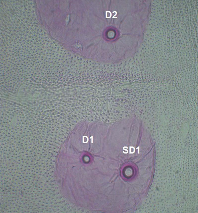 Cepeda y Cubillos: Clave de identificación para siete especies de tortrícidos. 39 Figura 1.
