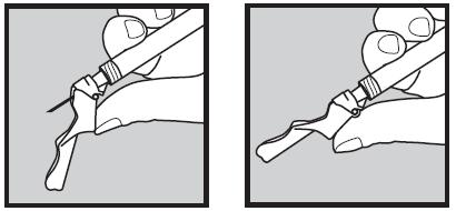 5) Inyección de Humira Con la mano libre, pellizque suavemente la zona de piel limpia y sujétela con firmeza. Con la otra mano sujete la jeringa formando un ángulo de 45 grados con respecto a la piel.