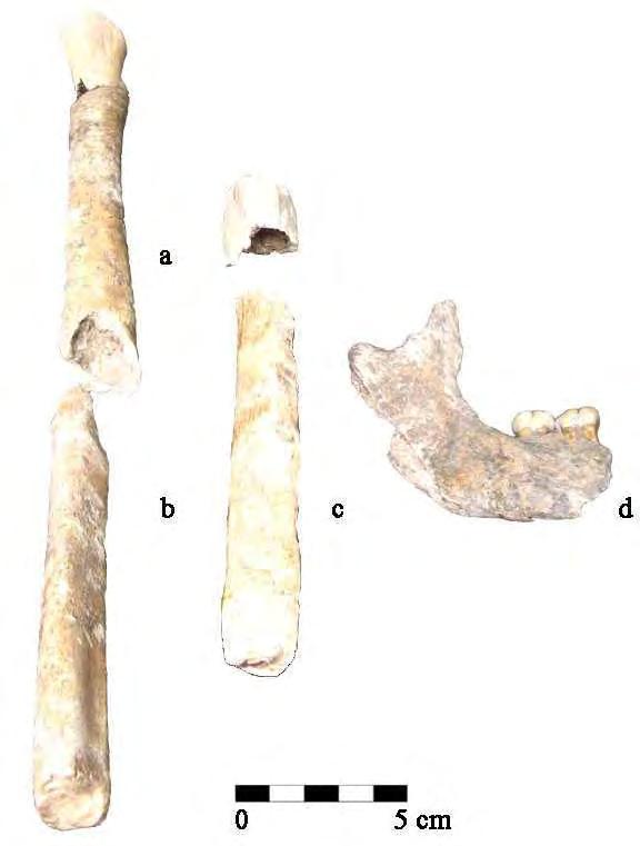 207 a 22 años que yacía en posición decúbito dorsal; este enterramiento contiene restos parciales del cráneo, la mandíbula (incluye dos molares y un premolar), diáfisis de cúbito, de fíbula, el fémur