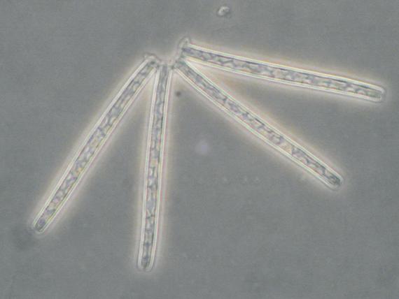 Thalassionema bacillaris, F: Rhizosolenia