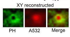 microscopía de superresolución verde: GFP dominio proteico de membrana rojo: