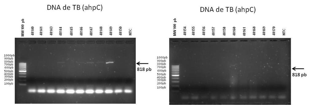 Amplificación y marcaje de productos de PCR con Dideoxiterminadores Se realizó una reacción de PCR secuenciación con el ADN de acuerdo al procedimiento del kit BigDye Terminator v3.1 Cycle Sequencing.