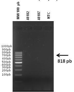 Figura 1. Electroforesis de productos de PCR. Se emplearon 100 ng del ADN amplificado. En el primer carril se colocó marcador de peso molecular en pares de bases (pb).