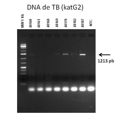 Figura 4. Electroforesis de productos de PCR. Se emplearon 100 ng del ADN amplificado. En el primer carril se colocó marcador de peso molecular en pares de bases (pb).