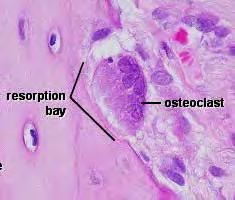 Tejido osteoide
