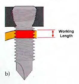 Working length von monocortical