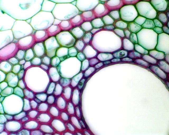 Ejercicio: De acuerdo a lo visto previamente Señala la posición de las celulas floemáticas y su posible tipo celular