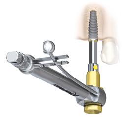 Manual de NobelReplace y Replace Select Tapered // Procedimiento quirúrgico 3 Inserte el implante Inserte el implante en la osteotomía a baja velocidad (25 rpm) y con un torque entre 20 45 Ncm.