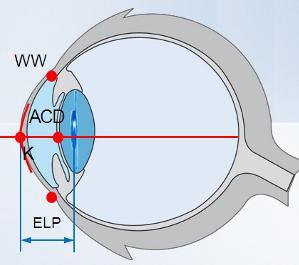 Figura 2.14 Factores que influyen en el cálculo de la ELP. Imagen procedente de los apuntes del Máster en óptica y optometría 2014/2015.