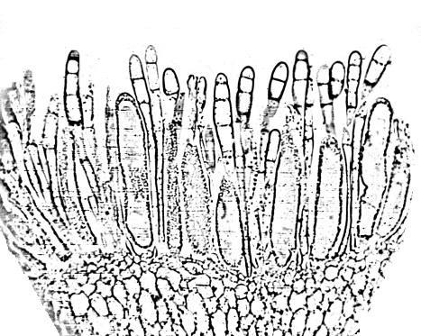3. Mnium, anteridio 1. anteridio a. espermatozoides b. saco estéril 2. perigonio 4. Mnium, talo semejante a hoja 1. costa a. hidroide b. leptoides 2. lamina 5. Musgo, protonema 1.
