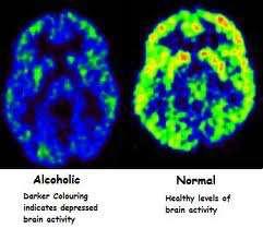 INTRODUCCIÓN ALCOHOL Sustancia psicoactiva Depresor del sistema nervioso central Afecta directamente funciones cognitivas Reduce el