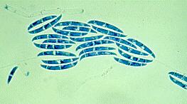 Micromorfología Micelio hialino, septado, con conidióforos ramificados o