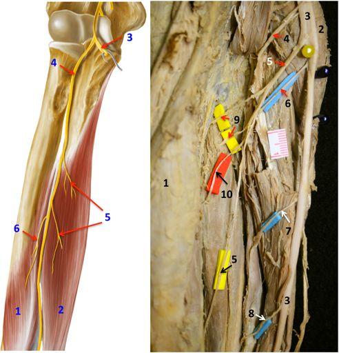 En un 93 % de los casos, este nervio también emitió ramos para el músculo flexor largo del pulgar (Fig. 3A - B).