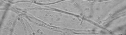 115 Trichoderma sp. Rhizoctonia sp. A Esclerocios B FIGURA 1. Cultivo dual del aislamiento 78 de Trichoderma sp. Rhizoctonia sp. (A) Testigo Rhizoctonia (B).