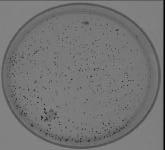 Por lo que en este caso se infiere que Trichoderma ha excretado al medio algún metaolito con acción fungistática sore el patógeno inhiiendo su crecimiento.