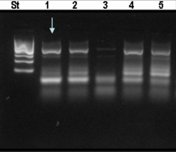 Figura 5. Electroforesis de los productos de PCR en gradiente de temperaturas de OMV, la flecha celeste indica el producto de PCR al utilizar una temperatura de annealing de 50oC.