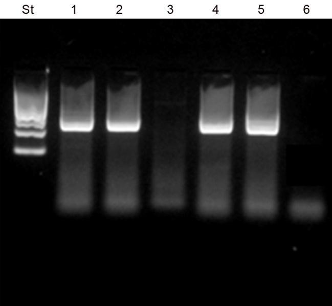Electroforesis de los productos de PCR en gradiente de temperatura de β-actina de Odontesthes regia.