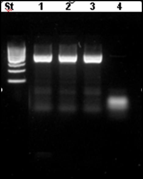 Figura 18. Electroforesis de productos de PCR de P. salmonis, se observa la amplificación del fragmento esperado de 470 pb. St: Estándar de Peso Molecular de 100pb; 1, 2, 3: Producto de PCR de P.