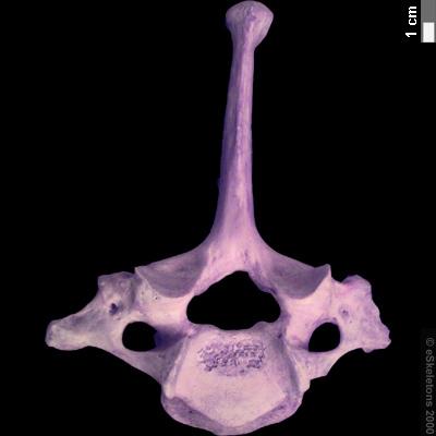 Vértebra cervical (c7) Bison 1. Espina neural o neuroapofisis 2.