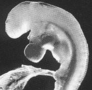 37 Objeción: en los primeros estadios del embrión estamos en presencia de un hombre en potencia, no de un individuo humano real, dado que falta la forma