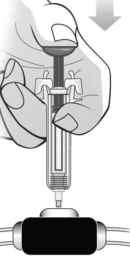 Saque la jeringa precargada del puerto venoso SIN soltar el émbolo. Suelte el émbolo permitiendo que el dispositivo de seguridad de la aguja de la jeringa proteja la aguja.