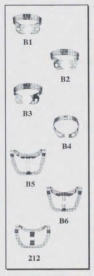 Grapas especiales Existen grapas especiales para diferentes procedimientos odontológicos, es importante conocer éstas y el uso que se les da a las mismas, como lo muestra la siguiente tabla y la
