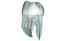Diseñado para mejorar la calidad del tratamiento Aísle la pieza dental de interés Visualice claramente la anatomía de la pieza en 3D Identifique todos los canales Localice con antelación