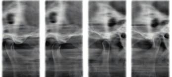 38 I 39 I 40 Más que imágenes: soluciones reales Radiografía panorámica Articulación temporomandibular Más soluciones para su