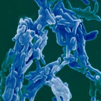 Mycobacterium tuberculosis Bacilo inmóvil Mide 0.3 a 0.