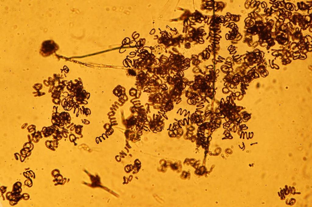 7 En relación a fitoplancton obtenido con red a 10 m. en sector la Poza tuvo predominancia relativa Anabaena spiroides, Fragilaria sp y Ceratium sp, todas especies bioindicadoras de eutrofización.