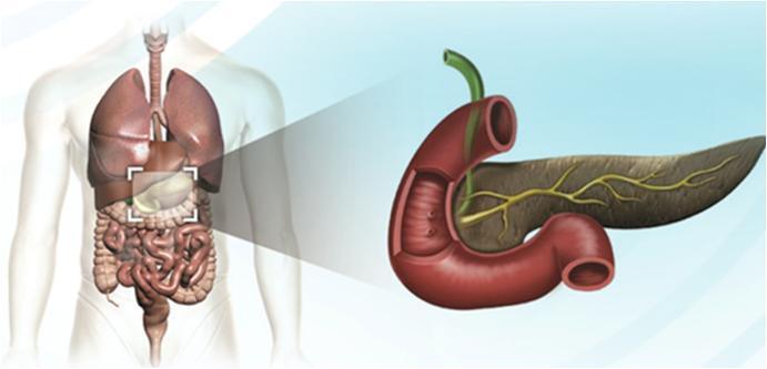 Trastornos Digestivos: ÍNDICE 1. Obstrucción intestinal 2. Ascitis 3.