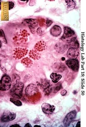 32. Las células con gránulaciones rojizas de Lisozima son: a) Eosinófilos de la sangre b)