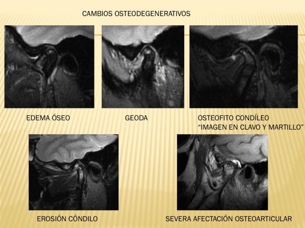 Fig. 20 References: Radiodiagnóstico, Fundación Hospital de Jove
