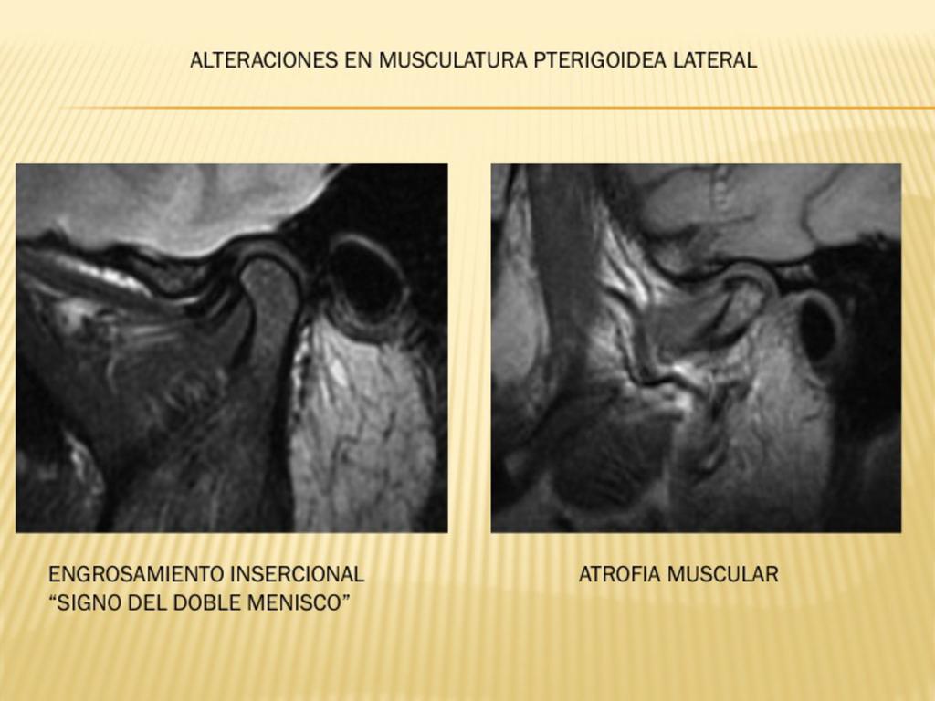 Fig. 22 References: Radiodiagnóstico, Fundación Hospital de Jove - Gijón/ES 3.
