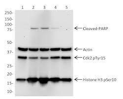 las PrPsc resistentes a proteasas, la proteína
