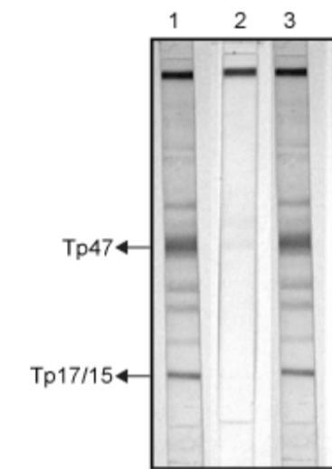 Western Blotting (WB) & Line immunoassay (LIA) Utilizan antigenos de T.