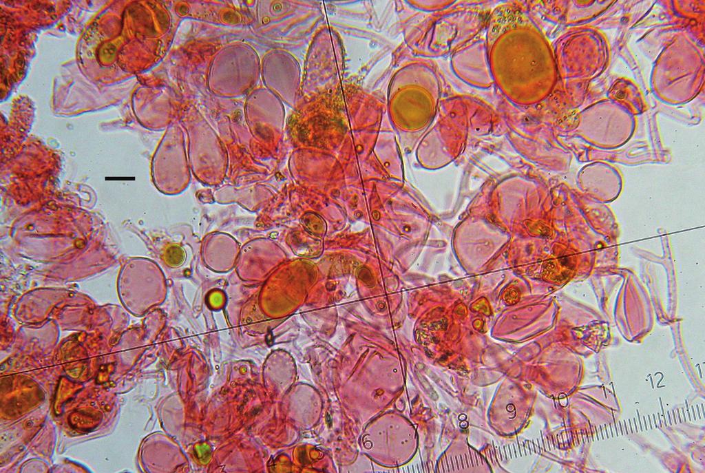 ARRILLAGA, P. & J. RIEZU Fig. 4. Favolaschia calocera. Elementos de la pileipellis. Barra=10 µm.