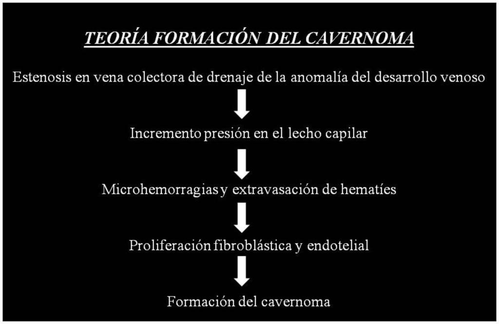 Table 4: Teoría para la formación de un cavernoma cuando existe una anomalía del desarrollo venoso.