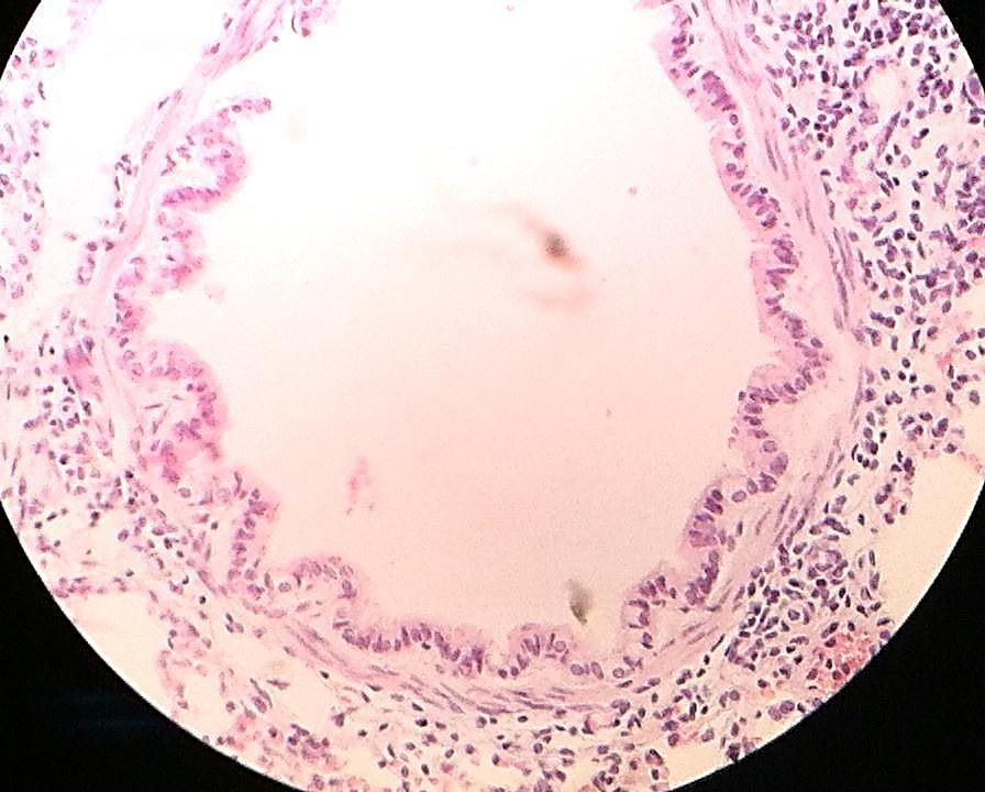 ciliado (células caliciformes