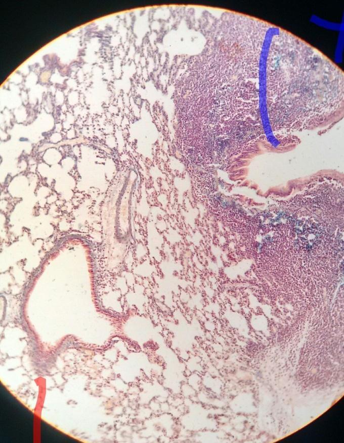 PULMON DE RATA Mucosa: Epitelio cilíndrico/cúbico ciliado.