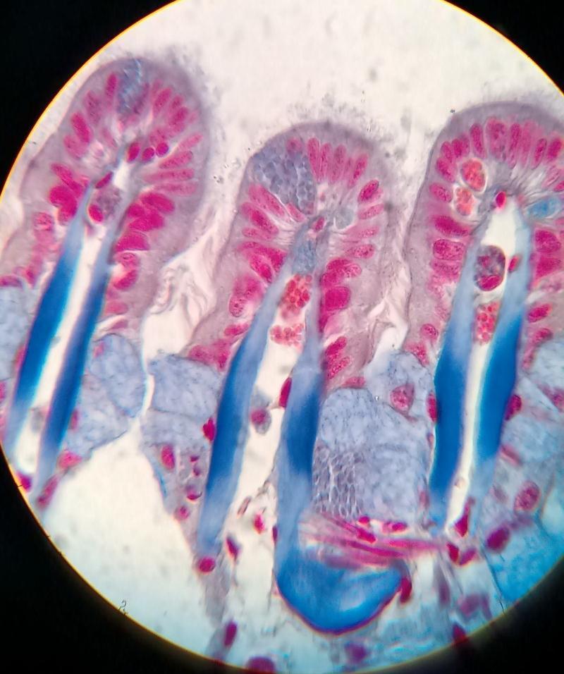 glandulares mucosas; 3) Células