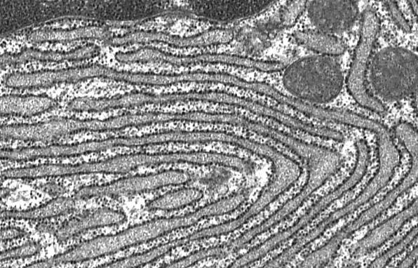 Retículo endoplásmico rugoso Denominado así por su aspecto debido a que presenta regiones tapizadas de ribosomas, donde se sintetizan proteínas de membrana (de